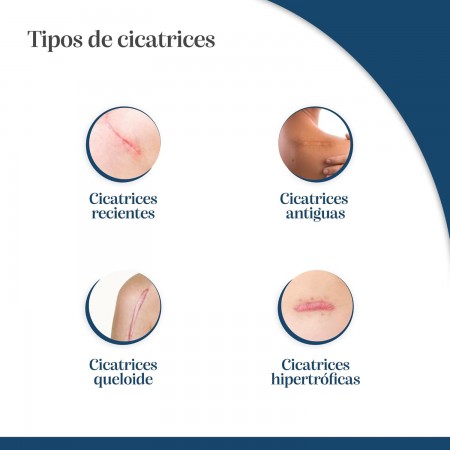 TROFOLASTIN CICATRICES CARRERAS 4CM X 30CM 5 UNIDADES