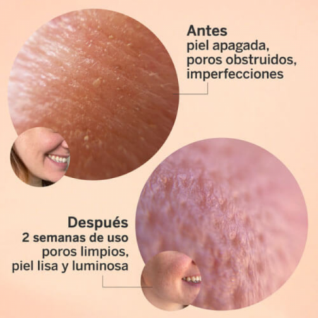 SEGLE SERUM GLICOLMIX EXFOLIANTE 30ML