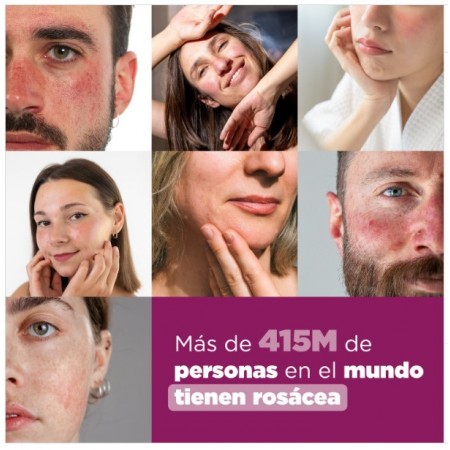 LETI SR AGUA MICELAR PIEL SENSIBLE Y ROSACEA 200 ML