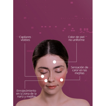 LETI SR CREMA ANTI ROJECES MINERAL SPF30 CREMA 40 ML