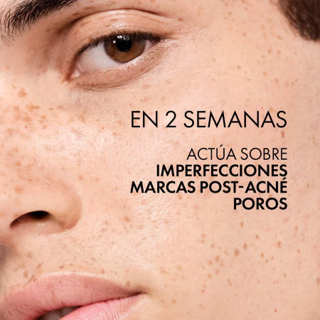 VICHY NORMADERM TONICO ASTRINGENTE PURIFICANTE 200 ML