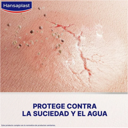 HANSAPLAST APOSITO LIQUIDO CONCENTRADO 1 TUBO 10 ML 60 APLICACIONES