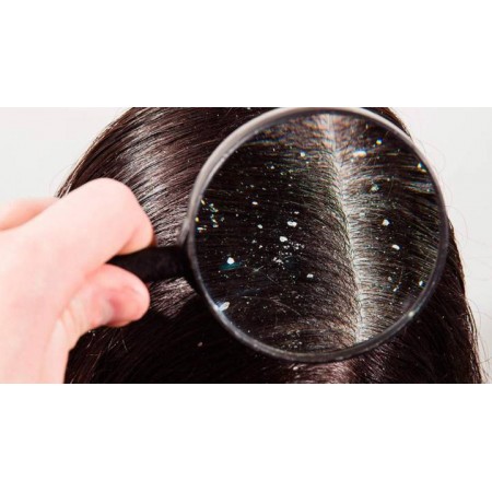 DERCOS ANTICASPA DS 2 EN 1 CHAMPU Y ACONDICIONADOR 200 ML