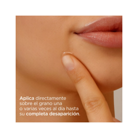 ISDIN OILY SKIN ACNIBEN 3 ON THE SPOT CORRECTOR IMPERFECCIONES LOCALIZADAS 15 ML