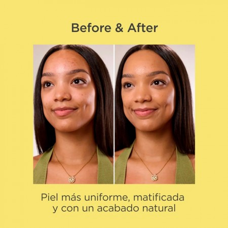 ISDIN OILY SKIN ACNIBEN CC+ CREAM  40 ML COLOR BRONZE