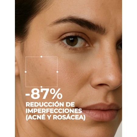 SEGLE PACK ACNE AHA/BHA CLEAR AZELAIC 30ML