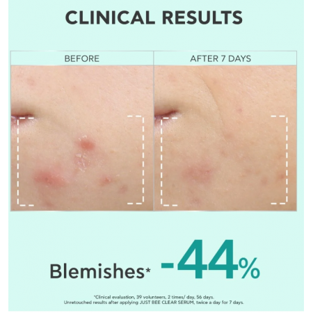 APIVITA JUST BEE CLEAR SERUM ANTI IMPERFECCIONES 30 ML