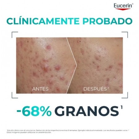 EUCERIN DERMOPURE CLINICAL PROBIOM8 RUTINA CON PROBIOTICOS 8 SEMANAS 4 PRODUCTOS
